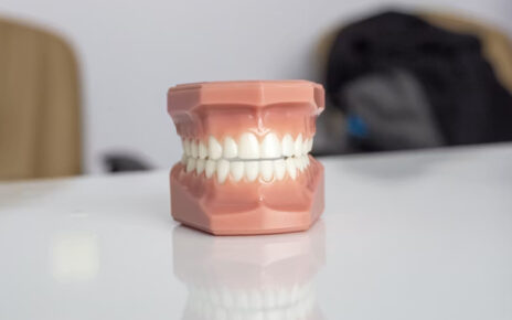 Prótesis dental